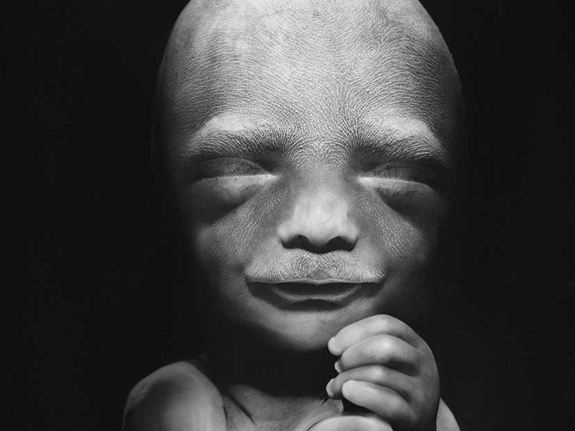 Lennart Nilsson’s Great Exploration in Science