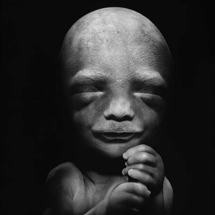 Foetus 20 weeks “A child is born”, 1965/2011