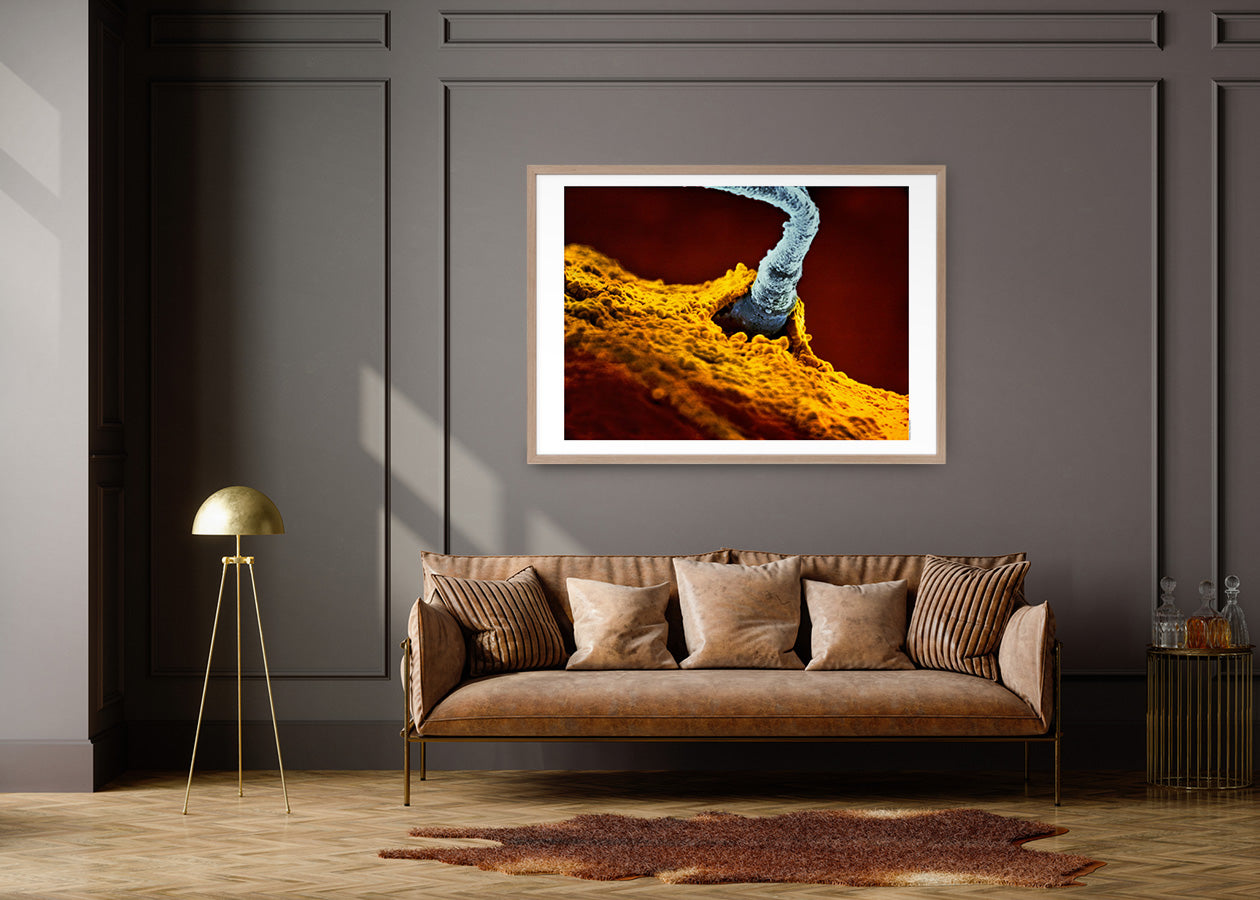 The Winning Sperm, 1990 “A child is born”