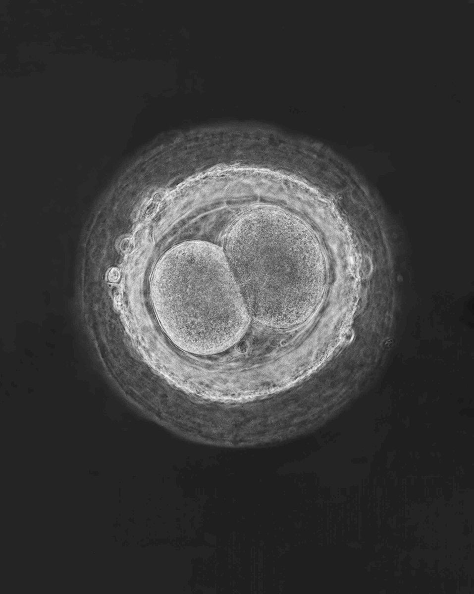 Fertilized egg cell, 1965 “A child is born”