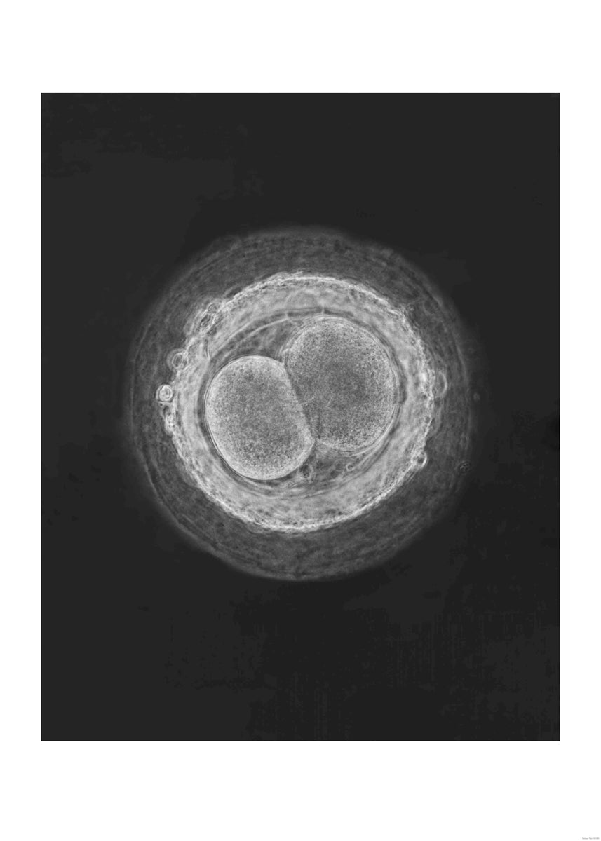 Fertilized egg cell, 1965 “A child is born”