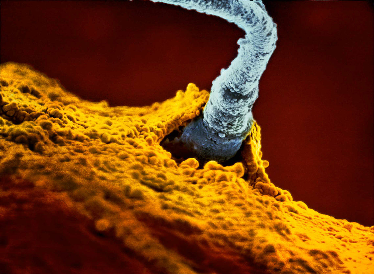 The Winning Sperm, 1990 “A child is born”