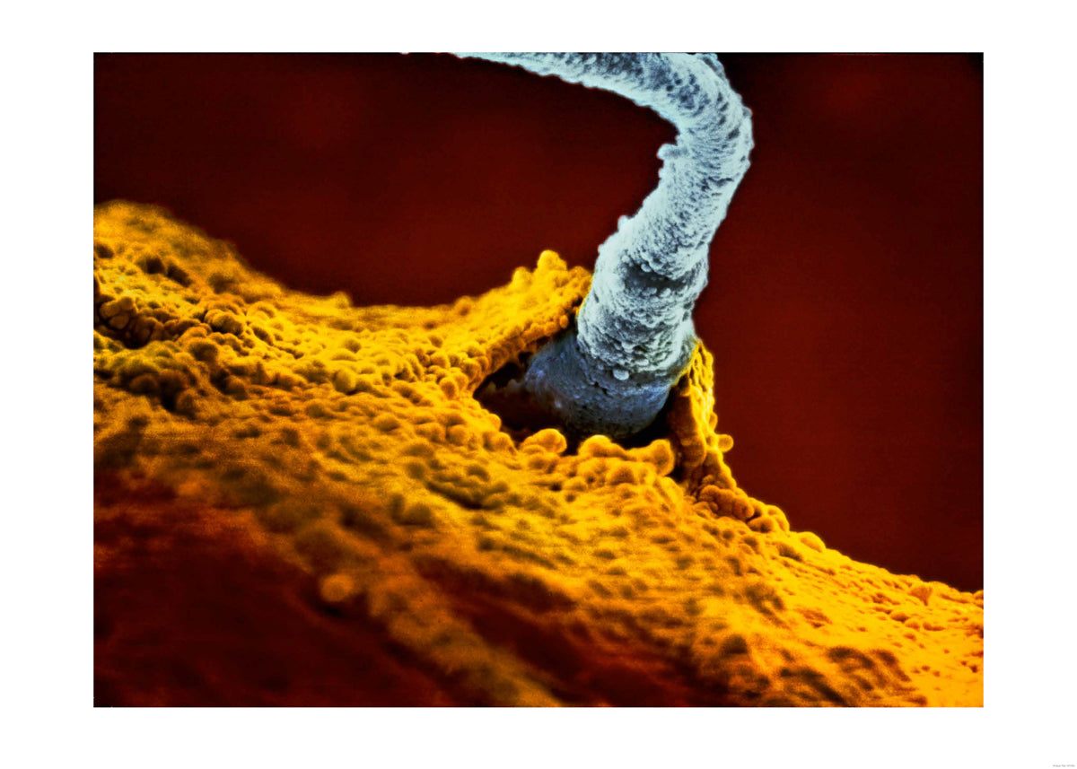 The Winning Sperm, 1990 “A child is born”